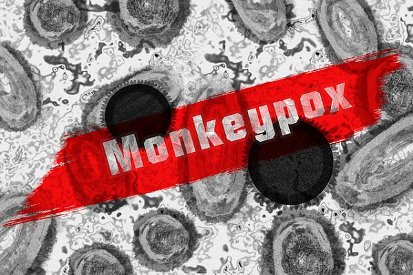 የእን Swob ፈተና አንቲጂን ሃርጋ-ከ 1000 በላይ የ Monikepox ጉዳዮች በብዙ አገሮች ውስጥ ተገኝተዋል!
